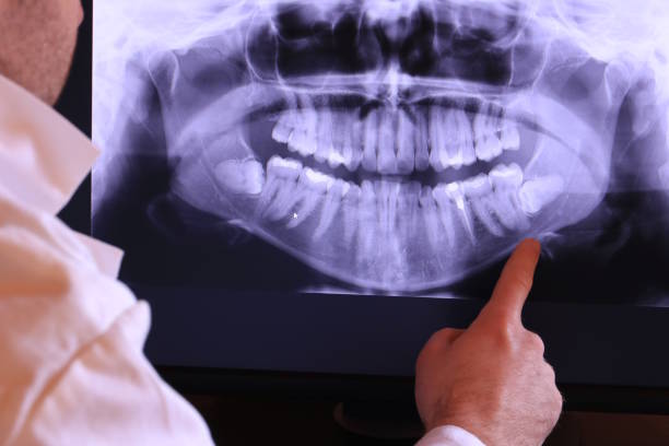 Best Emergency Dental Care for Abscessed Tooth in Maryville, TN
